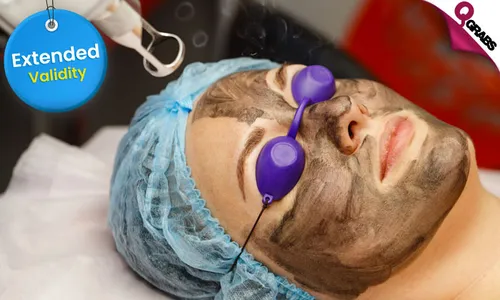 Carbon Laser Facial for Ladies & Men!